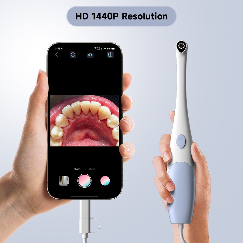 Cámara endoscópica oral 1440P, - Lighting Visual reseña y precio